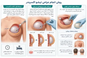 تیشو اکسپندر