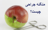 منگنه جراحی