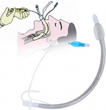 لوله تراشه چیست؟