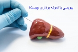 بیوبسی یا نمونه برداری چیست؟ چگونه انجام میشود؟