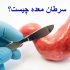 تنگی دریچه آئورت